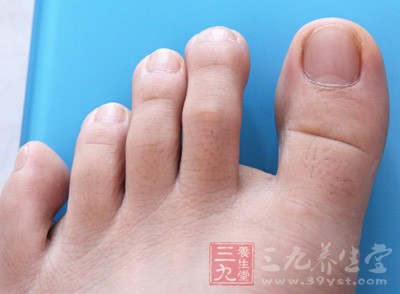 脚指甲因为受到鞋袜的束缚及保护