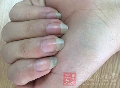 通常是胃酸分泌不足所导致